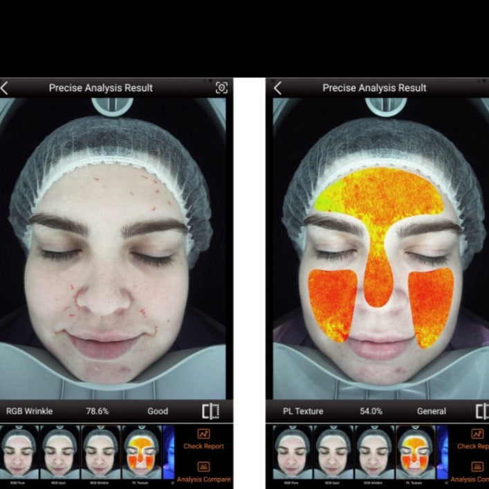 Zemits VeraFace Sistem Analisis Kulit